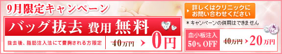 �L���L�����y�[�� �o�b�N������p�����@������50��OFF