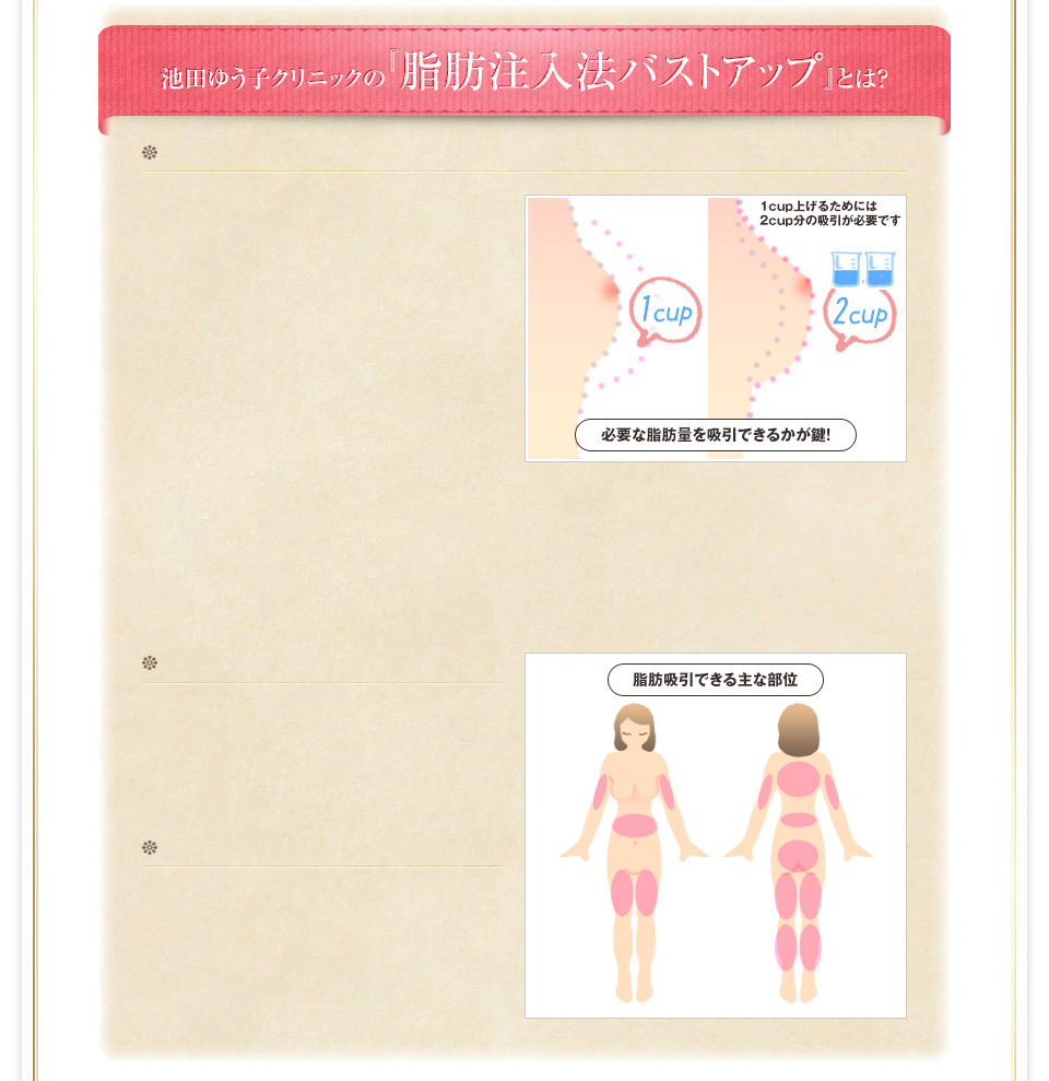 池田ゆう子クリニックの『脂肪注入法バストアップ』とは？