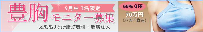 豊胸手術の値段(費用・料金)、モニター募集