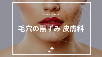 毛穴の黒ずみ 皮膚科