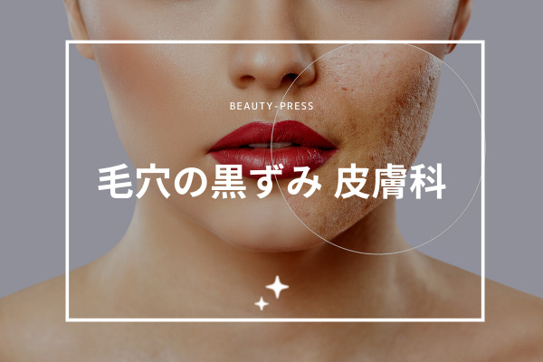 毛穴の黒ずみ 皮膚科