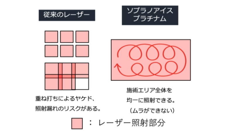 ソプラノアイスプラチナム