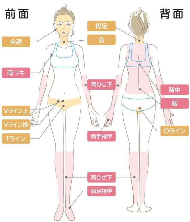 ルシアクリニック　シンプル全身脱毛　脱毛部位イラスト