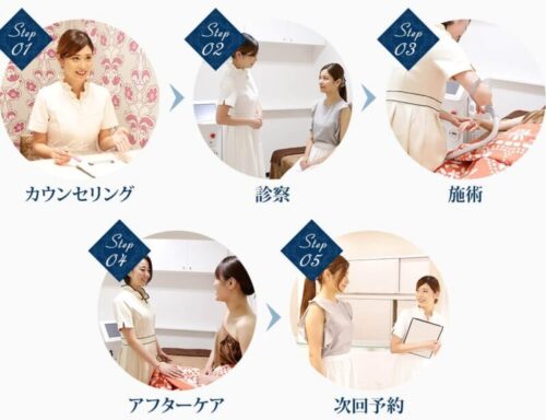 梅田ビューティクリニックの施術の流れ