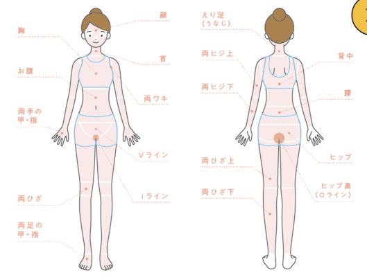 じぶんクリニック　脱毛部位
